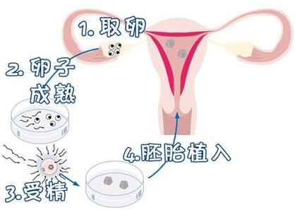 卵巢评估